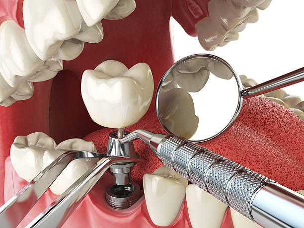 Best Walk-In Emergency Dental Services in Cavalier, ND