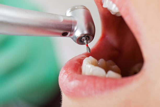 Reliable ND Emergency Dental Service Solutions